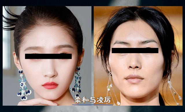 轮廓固定是什么医美项目做的，轮廓固定是什么医美项目做的好？